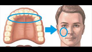 Semiología del Dolor en Endodoncia by Ricardo Rivas 698 views 3 years ago 6 minutes, 28 seconds