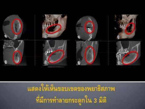 ประโยชน์ของ CBCT ในทางทันตกรรม โดย A7