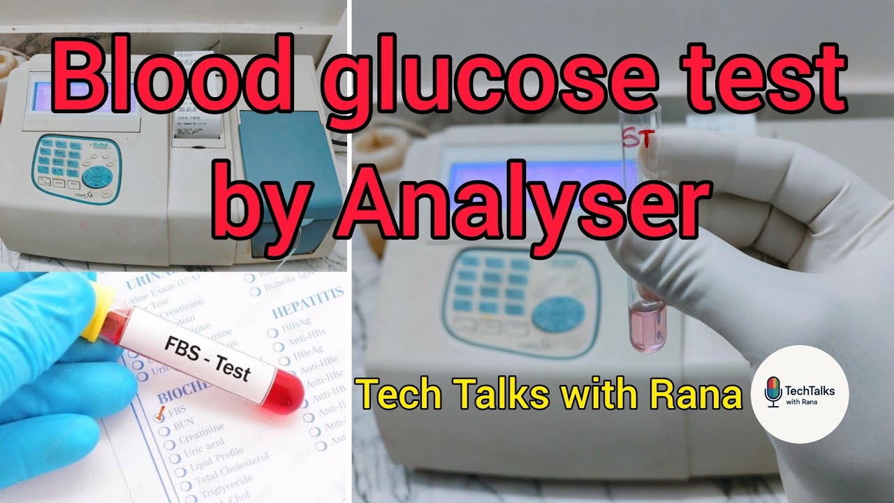 Blood glucose test by Analyser