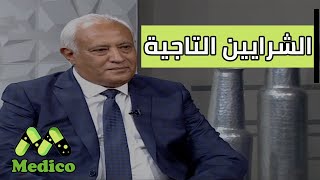 وظيفة الشريان التاجي وأهم الأمراض التي تصيبه والأعراض وطرق العلاج