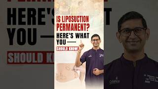 Liposuction Explained: Does Fat Come Back After Surgery? | Celebre Aesthetics Surat