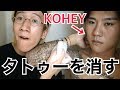 ジョンレノ、KOHEYのタトゥーを消すわ