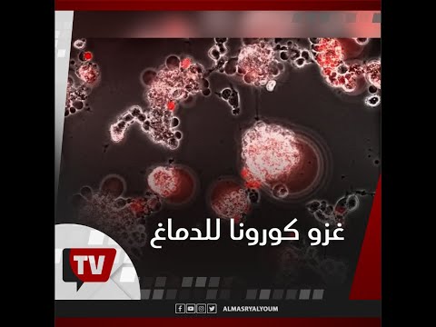 هكذا يغزو فيروس كورونا خلايا الدماغ