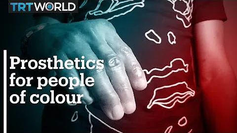 Dark skin prosthetics boost wearers' confidence in Nigeria