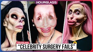 20 Celebrity Plastic Surgery Disasters | You’d Never Recognize Today