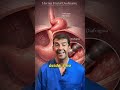 Hernia de Hiato, Esófago y Reflujo: cuando tu estómago sube donde no debe