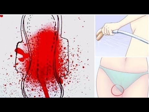 Βίντεο: Πώς να κάνετε τη ροή του αίματος