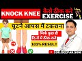 Knock Knee Kaise Theek Kare  || Treatment for Knock Knees in Hindi || Exercises for knock knees