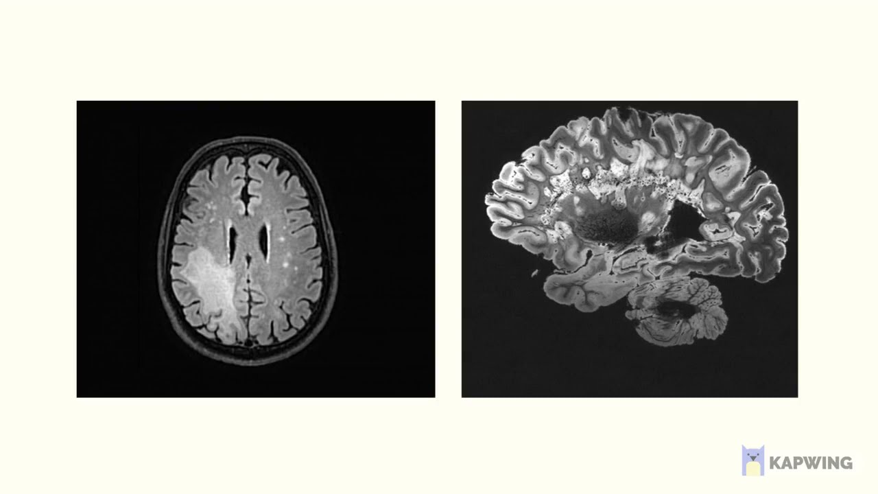 Undergraduate Talk Competition 2021: Daniel Owens "Limited Angle Tomography"