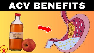 9 Apple Cider Vinegar Health Benefits |  ACV Benefits | VisitJoy
