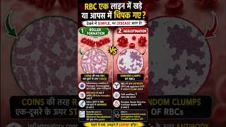 Rouleaux Formation vs Agglutination 🔬 RBC Coin Stack या Clumping? Explained Hindi #shorts