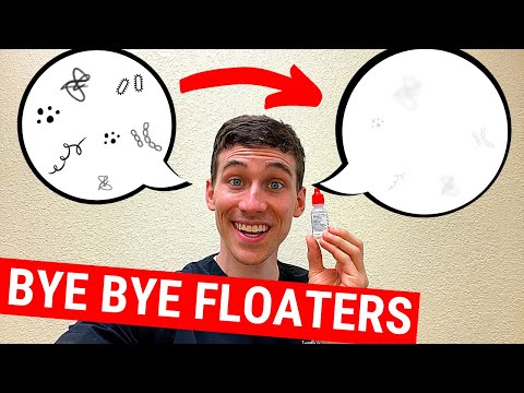 Eye Floaters CURE? - Atropine Eye Drops for Eye Floaters Explained