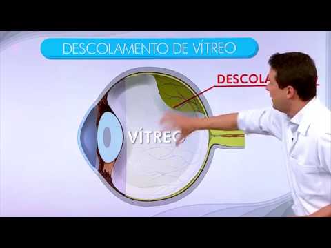 Vídeo: Telhas No Olho: Sintomas, Complicações E Muito Mais