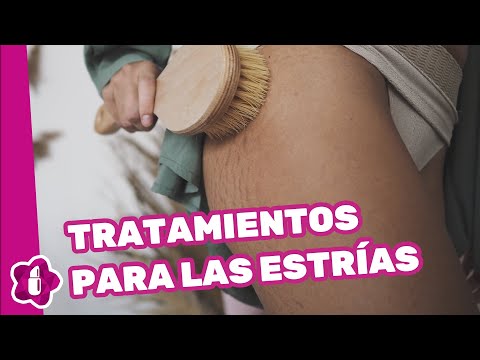 Cómo acabar con las estrías: tratamientos que existen