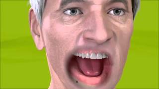 Straumann   Removable denture with bar