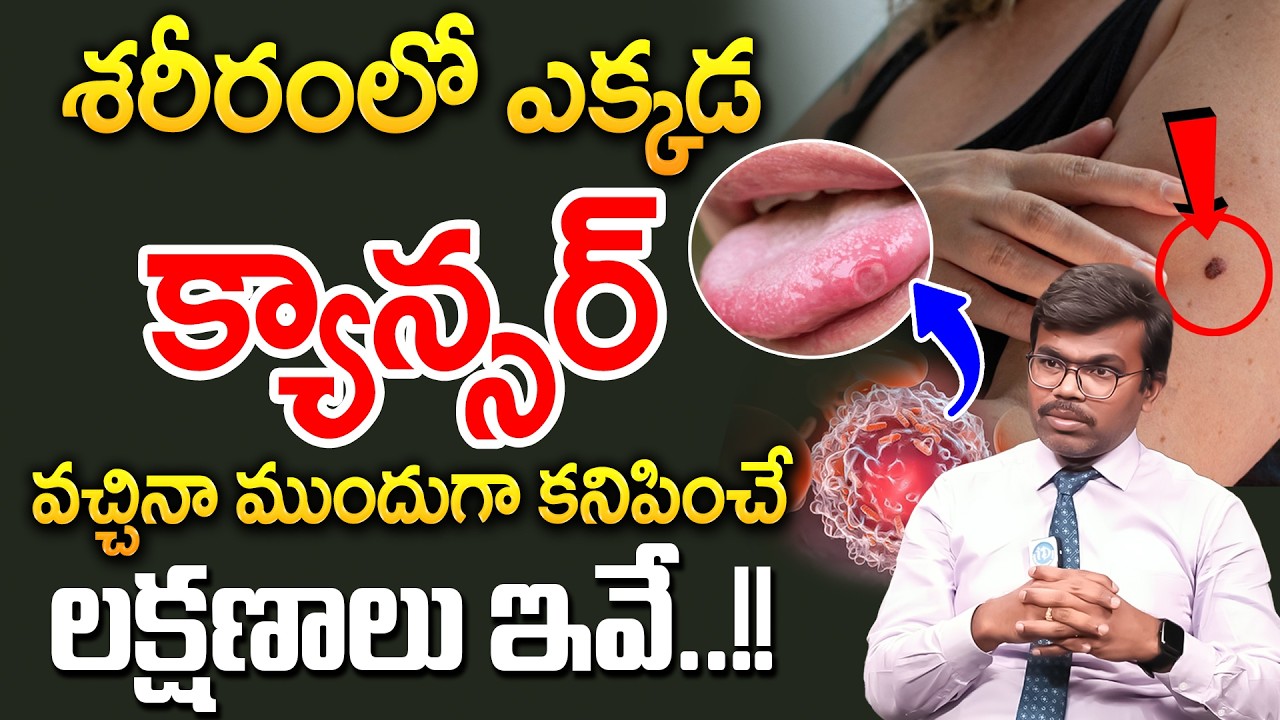 క్యాన్సర్ ఎక్కడ వచ్చినా ముందుగా కనిపించే లక్షణాలు ఇవే.! | Cancer Symptoms | Dr Chinna Babu | iDream