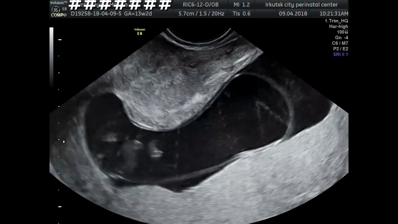 Акрания, микромелия и почки для Фреда