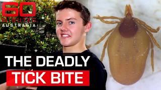 The bizarre tick bite that makes eating red meat deadly | 60 Minutes Australia
