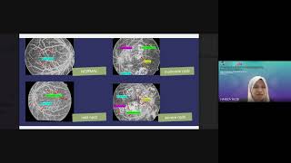 SIMMS 2023 - Severity Classification using Deep Learning for Diabetic Retinopathy