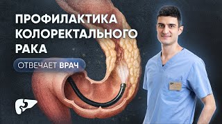 Колоректальный рак: симптомы, диагностика, группа риска