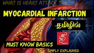 HEART ATTACK IN TAMIL - BASICS OF MYOCARDIAL INFARCTION.