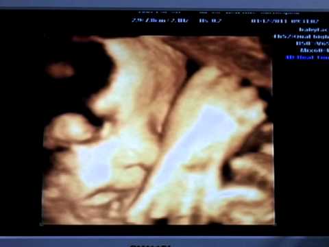 兔寶寶 34週 5天 體重2484 Youtube