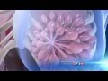 Self Breast Exam Medical Minute With Family Physician Dr Richard Honaker 