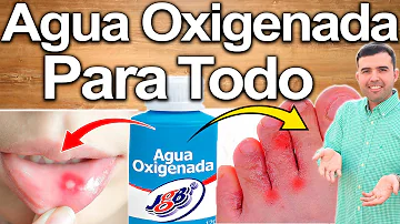 ¿Cuáles son los beneficios del agua oxigenada?