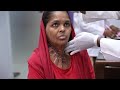 Face and Neck Damaged in Fire-accident Reconstruction - Pre Surgery