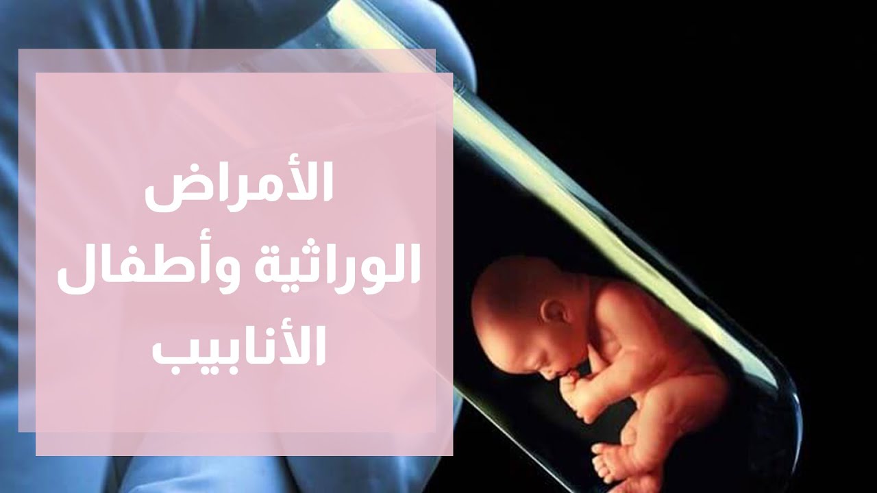 علاج الأمراض الوراثية بمساعدة أطفال الأنابيب