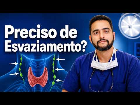 Esvaziamento Recorrencial: Quando Fazer no Câncer de Tireoide?