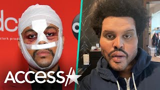 James Corden dresses as The Weeknd and covers his face in bandages for a  Super Bowl skit