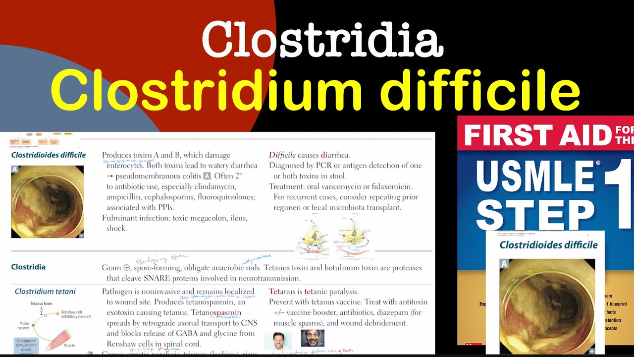Clostridium difficile in Hindi/Urdu by first aid for USMLE step 1 - YouTube