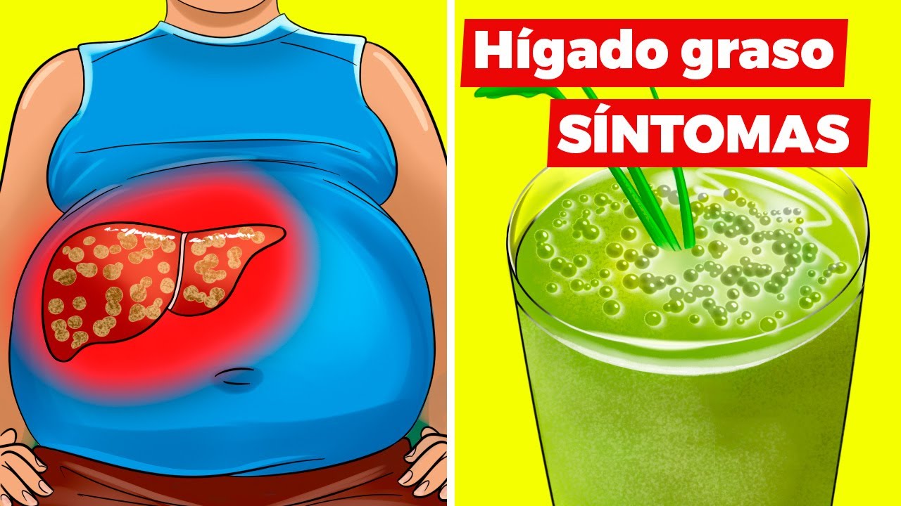 Dieta higado graso