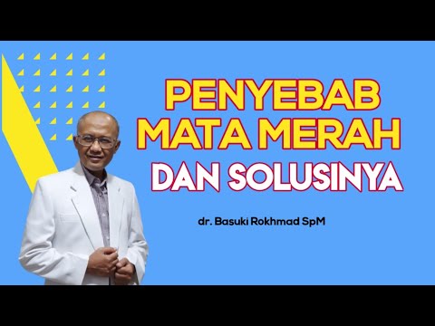 Ciri Ciri Mata Merah karena Iritasi dan Infeksi | dr. Basuki Rokhmad SpM