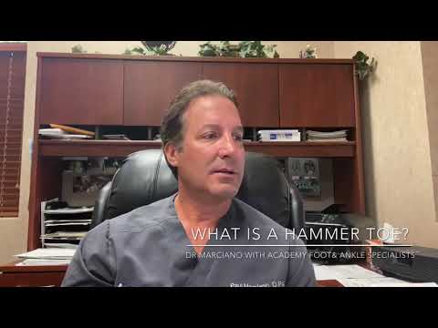 What is a hammer toe? - YouTube