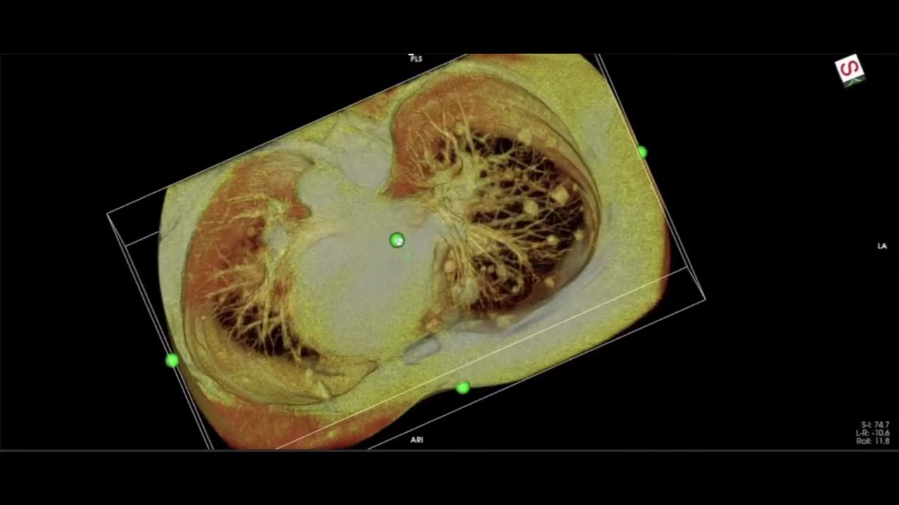 MedNexus Health Inc. Feat. SeeFactor CT3™ Advanced Imaging Technology