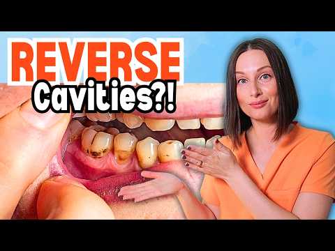 Cavities Explained: When Reversal is Still Possible