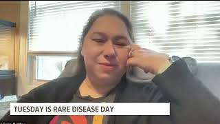 QC woman shares her story of living with a rare, life-threatening condition | This Week