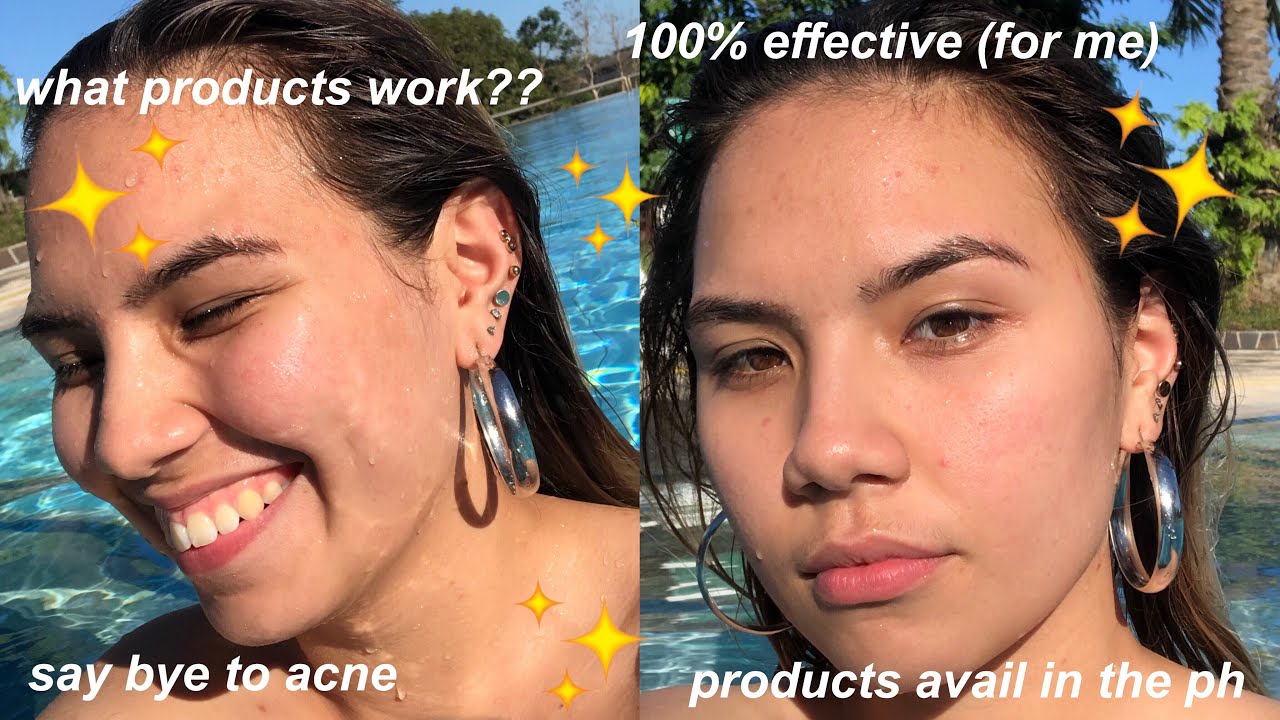 Skincare Routine for Prone Skin!! //Philippines YouTube