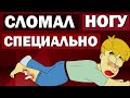 КАК Я СЛОМАЛ НОГУ (Анимация). Мои детские травмы. Перелом.