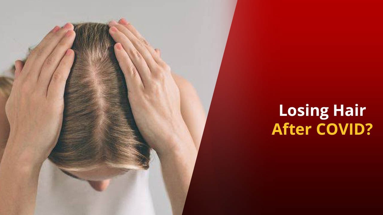COVID19: Is Hair-loss After Recovery Real? | NewsMo - thptnganamst.edu.vn