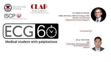 ECG in 60s - Medical student with palpitations (Vietnamese)