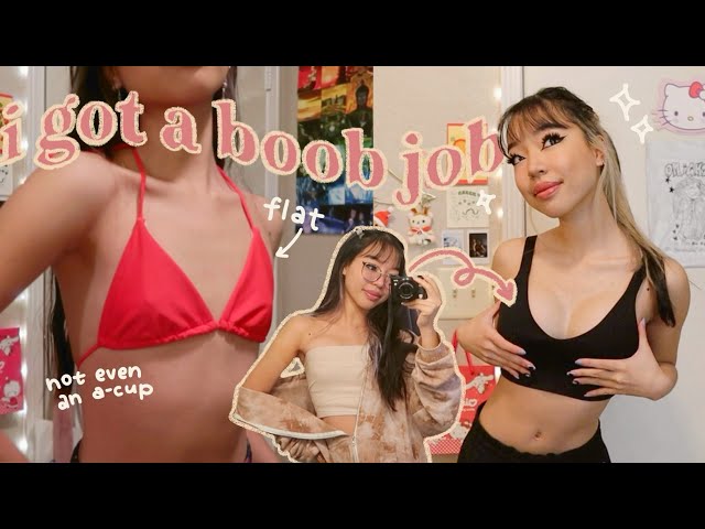 I GOT A BOOB JOB @ 20 yrs old… my experience, why i did it