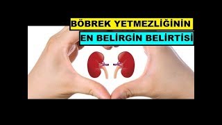 Download Böbrek Yetmezliği Nedir,belirtileri Nelerdir Ve Nasıl Anlaşılır Sorularını Cevap Video MP3 Böbrek Yetmezliği Nedir,belirtileri Nelerdir Ve Nasıl Anlaşılır Sorularını Cevap