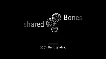 Mixed Reality CT-Scan Hologram - shared Bones
