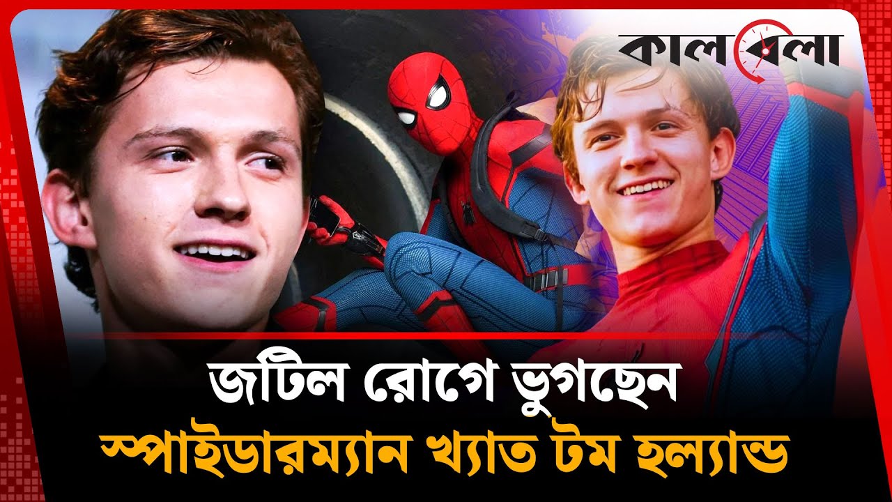 জটিল রোগে ভুগছেন স্পাইডারম্যান খ্যাত টম হল্যান্ড | Tom Holland | Spider Man‍ | Kalbela