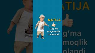 Maymoqlikni davolash. Маймокликни даволаш.   #ponseti #maymoqlik #methodponseti #clubfoot