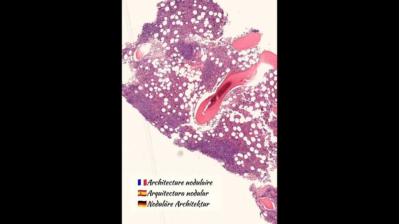 Russel, Marschalko, Dutcher... what are all these names?! 