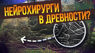 Андрей Жуков: Камни Ики - Древняя Медицина